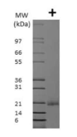 Novus Biologicals Recombinant Rat VEGF 165 Protein 500 &mu;g | Buy Online | Novus Biologicals&trade; | Fisher Scientific